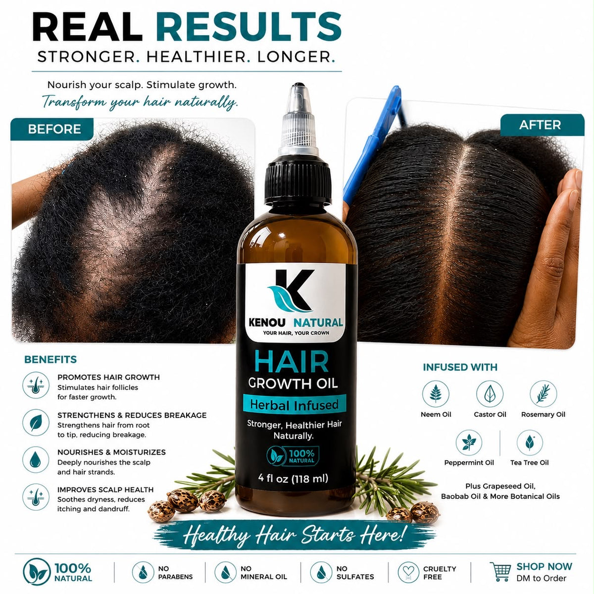KENOU NATURAL LLC